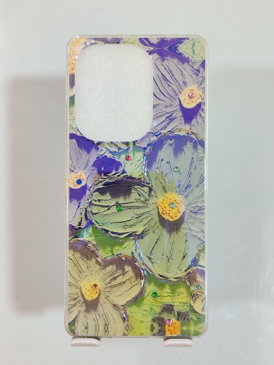 قاب Xiaomi Note13 pro
