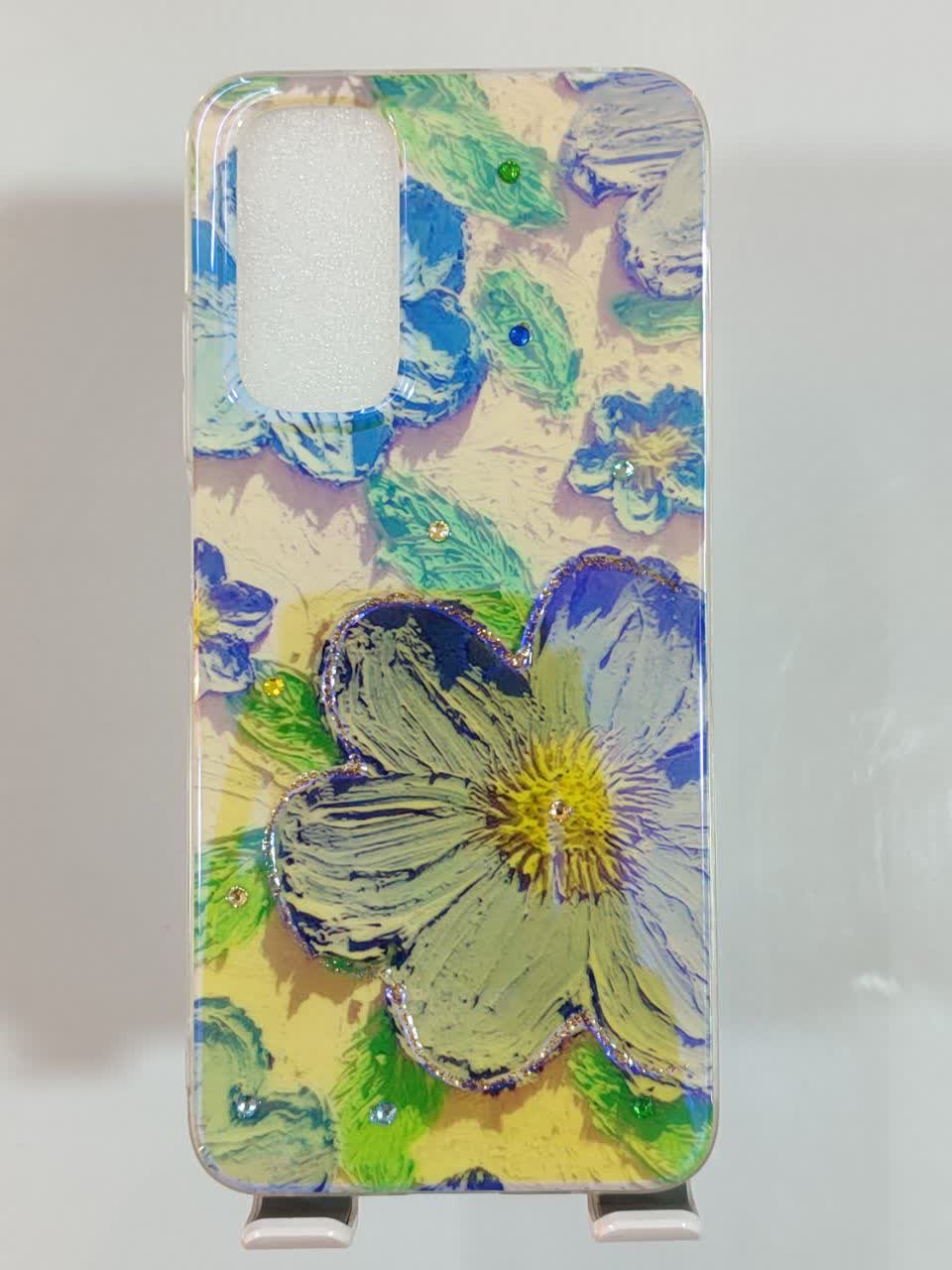 قاب Xiaomi Note 11/11s